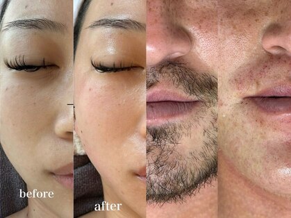 マリーブ 恵比寿本店(MAREVE)の写真