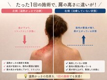 やまかわ整体院の雰囲気（女性の来院多数。肩こり肩甲骨特化院「原因」を解明し快適な体へ）