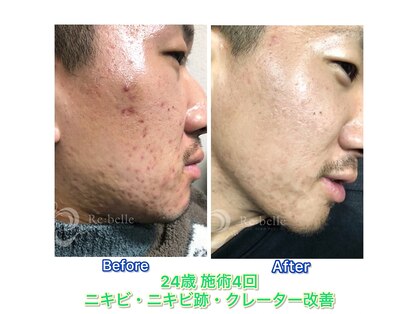 ブルービードロ メンズ美肌科学研究所(Blue beedro)の写真