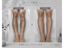 ビダン(BIDAN)の雰囲気（【メンズ脱毛】男の身だしなみは脱毛から。）