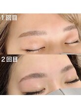 キンキー 広島(kinky)/