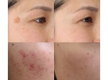 ナチュレアンドメディカ(Nature&Medica)