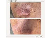 アンド(&.)/before/after