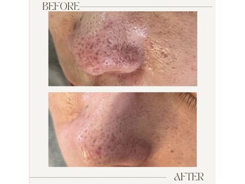 アンド(&.)/before/after