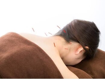 あわじ鍼灸室の写真/頭痛/眼精疲労/肩こり/腰痛/眠りが浅い方/むくみ/リフトアップ◎お悩みへ根本からアプローチ◎