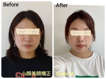 スマイルエム(SmileM)/