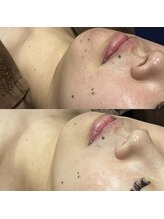 アトリエドット(atelier.)&nbsp;人気No,3 肌管理