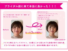 理想の小顔 福島店の雰囲気（痛みが少ない優しい施術！お悩み別にメニューをご用意♪）