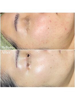 ちらちゅら/クリスティーナ