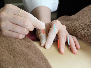 うさぎ鍼灸院 エバーグリーン大川店の写真/【深部のコリにアプローチ】国家資格取得者による鍼灸施術◎不調の原因を追求し根本改善を目指しましょう♪