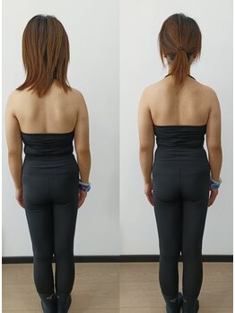 長寿堂 東洋整体院/背中矯正3