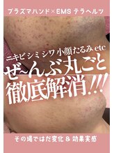 エンネソルミオ(Enne Solmio)/プラズマスターケア☆