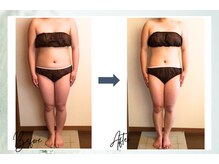 ポノ 茅ヶ崎(Pono.)/セルライトゼロ3か月【痩身】