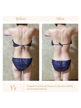 ワイズ(Y’s)/背中の張りくびれ作りに！