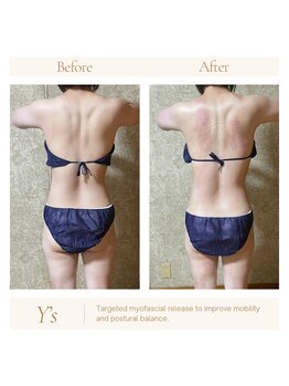 ワイズ(Y’s)/背中の張りくびれ作りに！