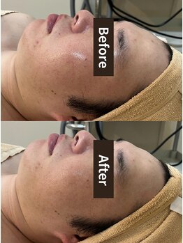 ラカ 川中島店(LaKa)/むくみオフで小顔印象