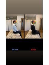 ヴィバランス(Vebalance)/巻き肩矯正