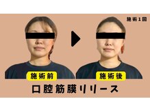 ミロク178式プロデュース(MIROKU178式プロデュース)/圧倒的リピート率！