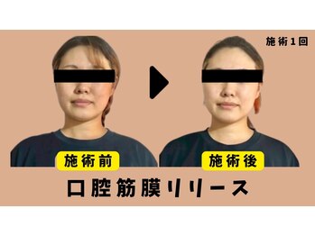 ミロク178式プロデュース(MIROKU178式プロデュース)/圧倒的リピート率!