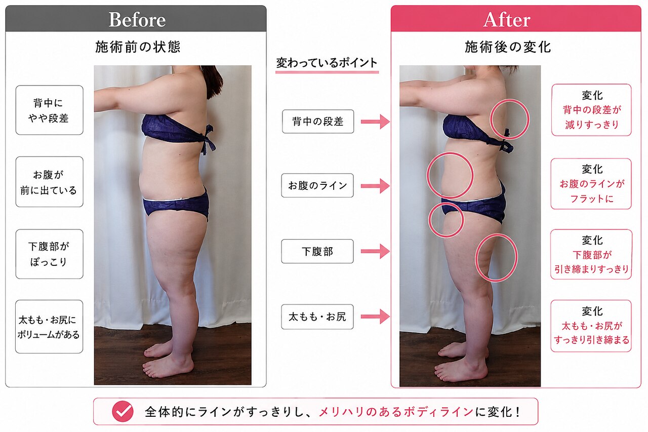 ヨサパーク ヴィオレット(YOSA PARK VIOLET)｜ホットペッパービューティー