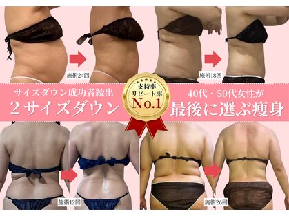 マキシア(MaxiA)の写真