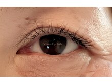 ヴィーナス アイビューティー(VENUS Eye Beauty)/施術例☆
