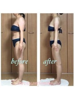 ラヴィソンファム(Ravissant femme)/痩身エステ/ビフォー&アフター