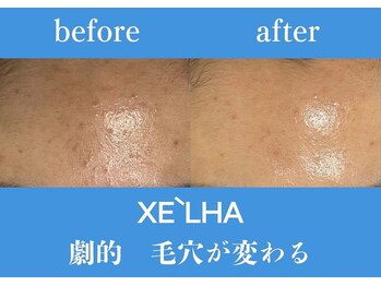 パールホワイトニング/ノーファンデでも毛穴がないお肌