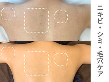 アンシャンテ 神戸元町店(Enchante)/ブライダルエステ神戸元町三ノ宮