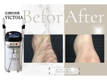 ソイビューティー(Soi beauty)/VICTOIAで全身マルっと美肌に◎