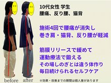 とりまる整体院 アイワイ(iy)/ 10代の学生の腰痛・姿勢改善