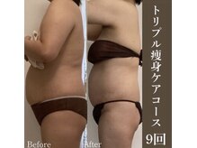 サロンドペシェ(salon de peche)/トリプル痩身コース9回