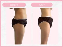 RHB 横浜店/【痩身コース】ビフォーアフター