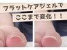 FOOT巻き爪矯正【フラットケアジェル】￥4500