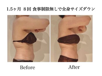 ナチュラーレ 天王寺店(Naturale)/痩身リンパマッサージ二の腕美脚