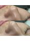 ラウラボ バイ ウォーヴォ(RAW LAB by UOVO)の写真/【エステ初心者でも◎】理容室併設のメンズ専門で毛穴洗浄体験！黒ずみやテカリ、いちご鼻が気になる方も！