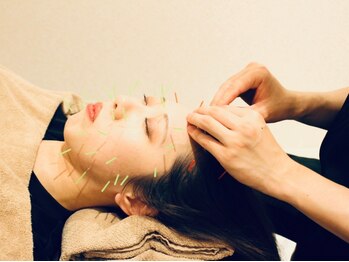 クマノミ美容鍼灸 池袋院(KUMANOMI美容鍼灸)の写真/【小顔美容鍼+電磁パルス】引き上がったフェイスラインを形状記憶★電磁パルスの刺激で頭皮から引き上げ!