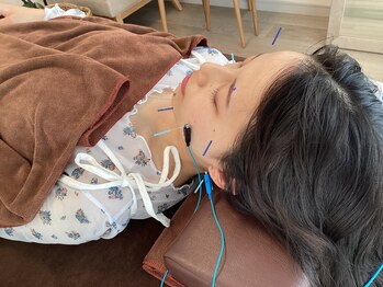 ハリファ鍼灸院 横浜関内院(HariFa鍼灸院)/美容施術