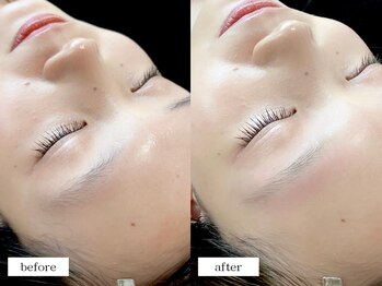 エムドット(m.)/アイブロウワックス脱毛