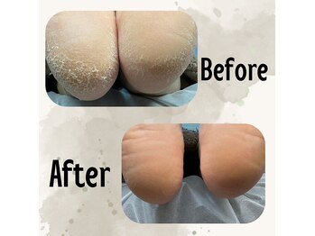 シトリン(Sitrine)