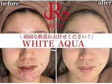 ホワイトアクア 京橋店(WHITE AQUA)の雰囲気（エステが初めての方もピーリング専門店にお任せください!）