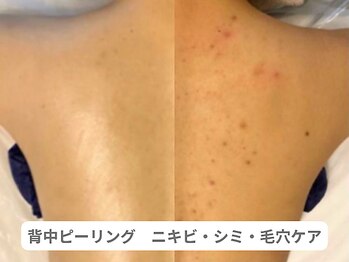 アンシャンテ 神戸元町店(Enchante)/ブライダルエステ神戸元町三ノ宮