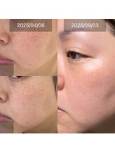 グレイス(Grace)/周りから褒められて気づいた変化