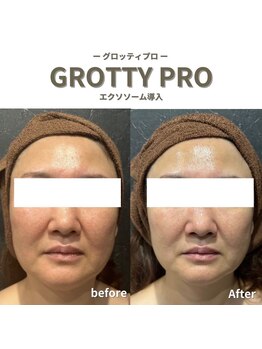 フルアナ(Hu ruana)/フェイシャルエステ