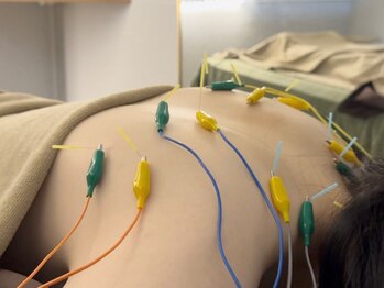 しゅんぷう/【鍼灸/鍼】