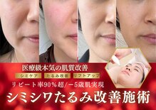 ハナチュチュ 矢場町店(Hanachuchu)