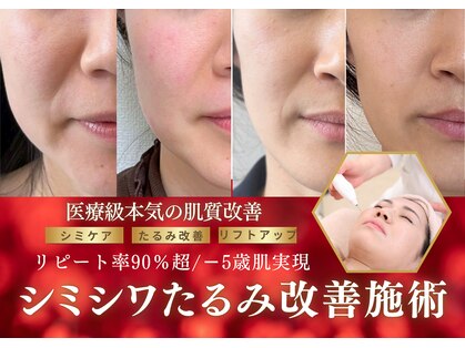 ハナチュチュ 矢場町店(Hanachuchu)の写真