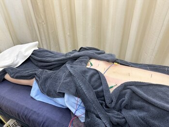 えん鍼灸院 整骨院の写真/【21時迄◎】肩こり・眼精疲労・腰痛等お任せ。慢性~急性まで、痛みやコリを鍼灸整体で根本改善へ