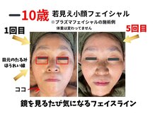 トータルビューティー雅の雰囲気（鏡を見るのが楽しみになる若々しい小顔へ）