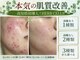 サロンアン(Salon an)の写真